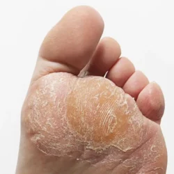 پدیکور حرفه‌ای در دریاچه چیتگر | رزرو فوری ☎️ 09125981442