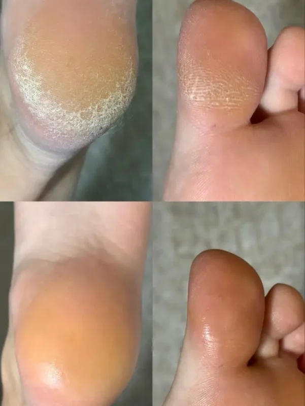 پدیکور حرفه‌ای در تهران