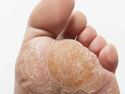 پدیکور حرفه‌ای در دریاچه چیتگر | رزرو فوری ☎️ 09125981442